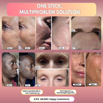 PDRN Collagen Volume Multi Balm