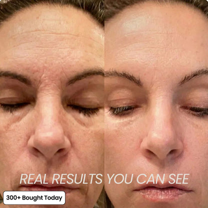 PDRN Collagen Volume Multi Balm